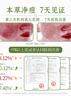 御养宜清痘草本面膜粉袪痘控油舒缓修护温和草本润肤双11礼物