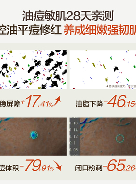 【双11抢先购】HBN磨皮水乳套装油皮控油祛痘平闭口保湿护肤品