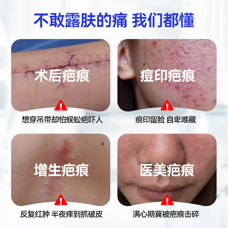 LAPOR医用疤痕凝胶祛疤膏去疤淡印疤痕修复官方正品30g/支A