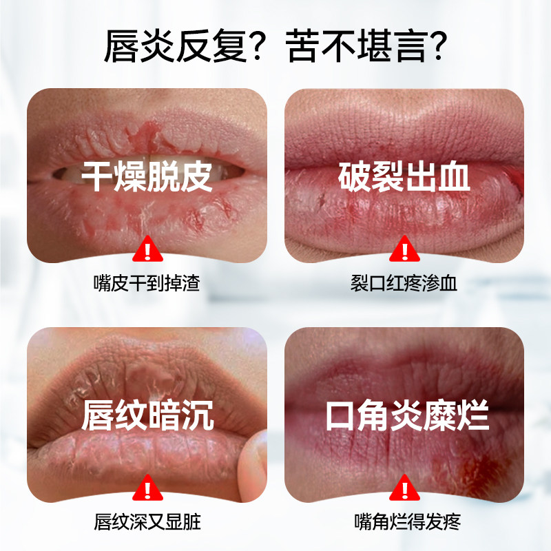 LAPOR医用聚乙二醇保湿敷料润唇膏创面保护唇部润滑保湿修护养唇A