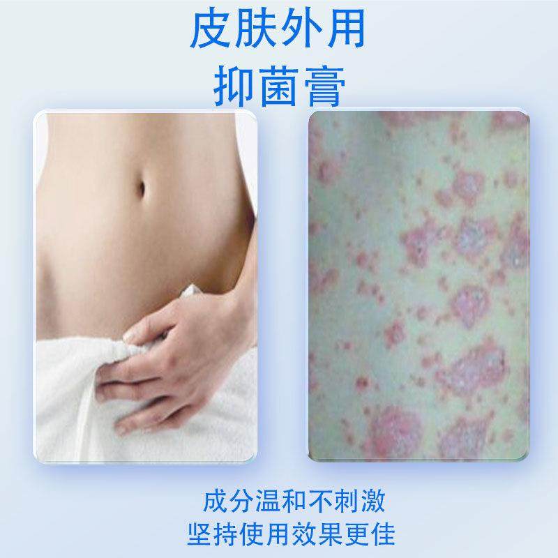 林旦乳膏阴虱正品官方抑菌硫磺乳软膏私处止痒男女洗剂852513378,淘宝优惠券,粉丝福利购,淘宝优惠卷