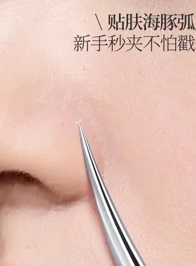 【超尖精工】高精海豚夹新手友好挑痘清粉刺闭口神器脸鼻清洁用ZF