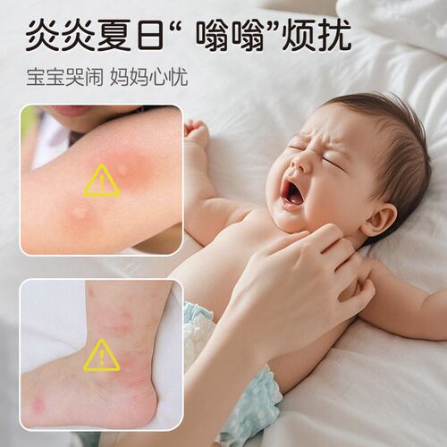 朋禾柠檬草喷雾儿童专用夏天户外常备婴幼儿宝宝温和呵护防翁液 - 图2