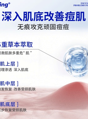 冰王痘克清痘修痕液祛痘去痘痘淡化痘印痘坑痘疤下巴痘女男士学生