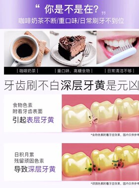 介意慎拍舒客牙膏酵素亮白去黄清新口气旅行实惠装含氟去牙渍克