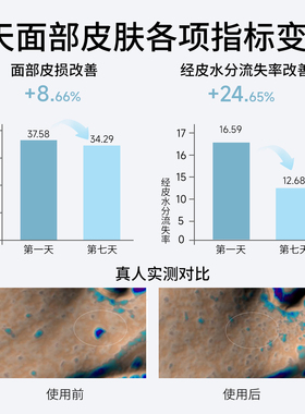 爱茉博士祛痘水乳植萃修护舒缓