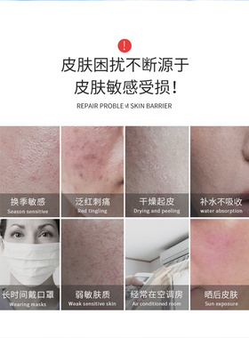 表皮生长因子喷雾修护敏感肌泛红