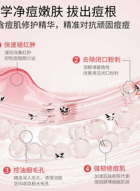 Geboline15%壬二酸凝胶祛痘印修复淡化膏任水杨酸去黑头收缩毛孔