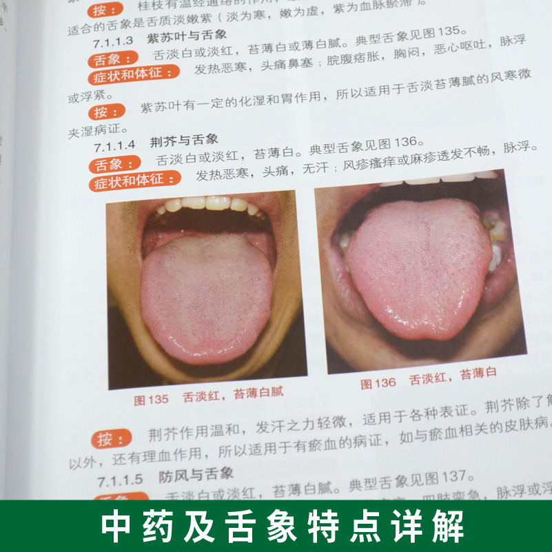 正版书籍 临床实用舌象图谱 精装 图解舌诊口腔科中医舌诊完全图解书籍 常用中药药剂和方剂学 中医诊断学中医书籍 中医舌诊入门书