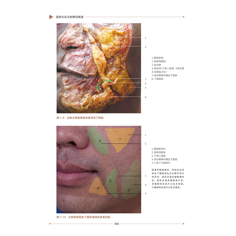 正版包邮 面部分区注射解剖图谱 金光龙著 整形书 面部微注射技术解剖基础医学生医学美容临床医学书籍面部注射医学技术微整形书 - 图1