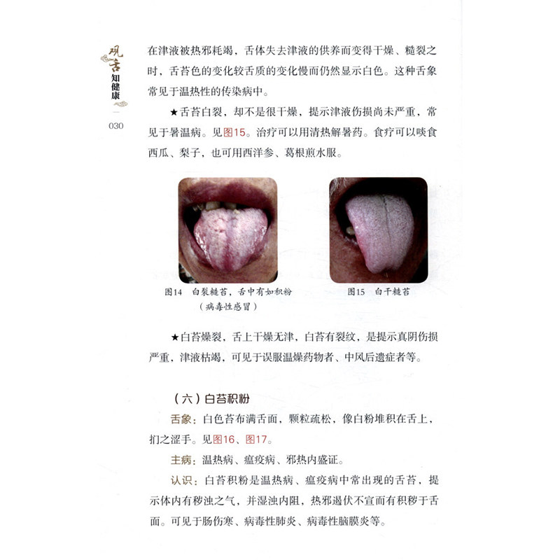 观舌知健康从零开始学舌诊中医学高清彩图一看就懂家庭医生舌诊书籍舌诊辩证图解儿童成人舌诊多种常见病舌诊中医养生书籍_虎窝淘