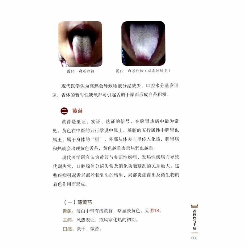 观舌知健康从零开始学舌诊中医学高清彩图一看就懂家庭医生舌诊书籍舌诊辩证图解儿童成人舌诊多种常见病舌诊中医养生书籍_虎窝淘