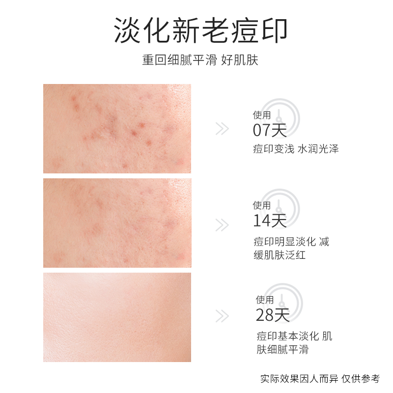 健美创研旗舰店3瓶|寡肽原液淡化痘印祛痘疤修复痘坑收缩毛孔改善面部男女精华液2