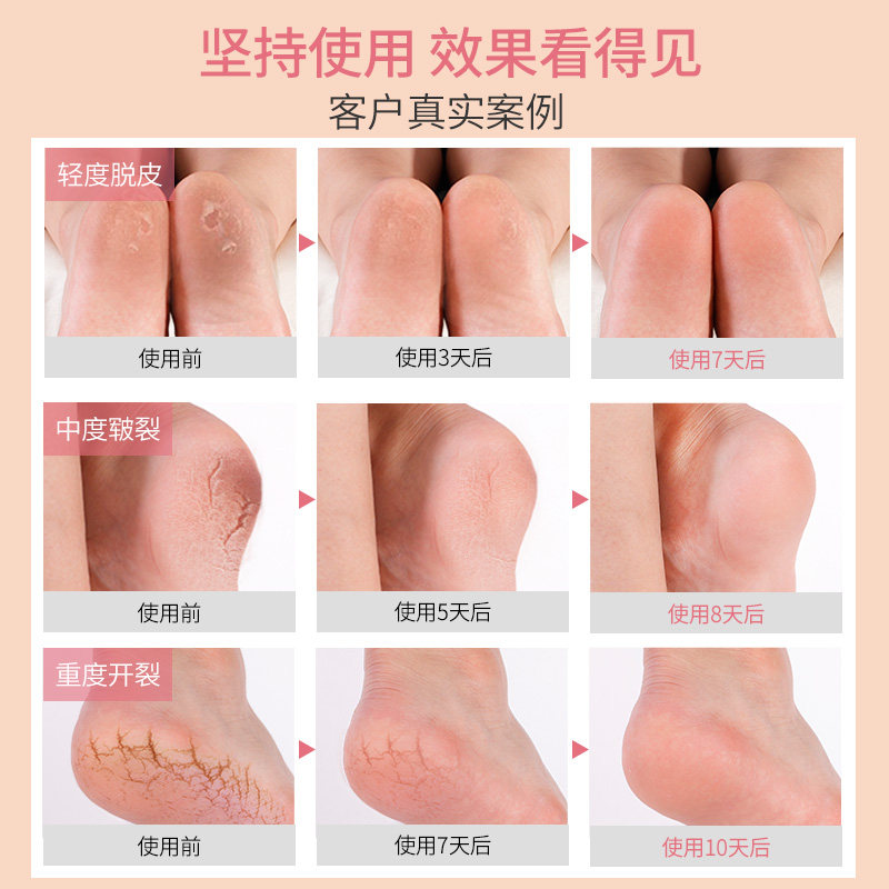 3双脚后跟干裂开裂防裂套男女丝袜 足典短袜/打底袜/丝袜/美腿袜