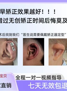婴儿耳朵矫正器医院同款硅胶耳夹