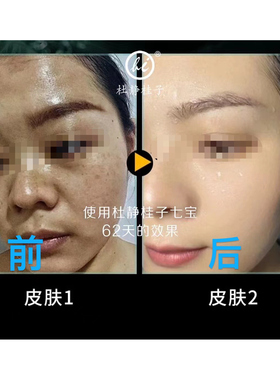 杜静桂子护肤品套装提亮
