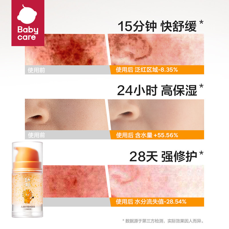 babycare幼朴儿童面霜宝宝可用春夏季保湿降温修护金沙润肤霜