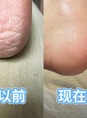 韩国美康三得毕护足霜