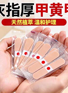 香港专研灰指防护专杀真菌指板足部美甲店灰趾美甲净萃取植物