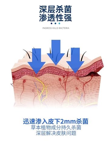 狗廯猫廯狗狗真菌螨虫感染宠物皮肤专用喷剂黑下巴结痂脱毛发炎-图1