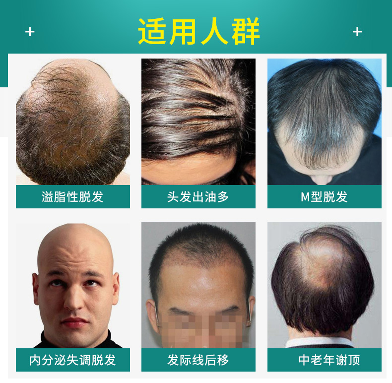 宜度海外专营店美国进口biotin生物素h防脱发胶囊生发增发维生素b6b7搭非那雄胺3
