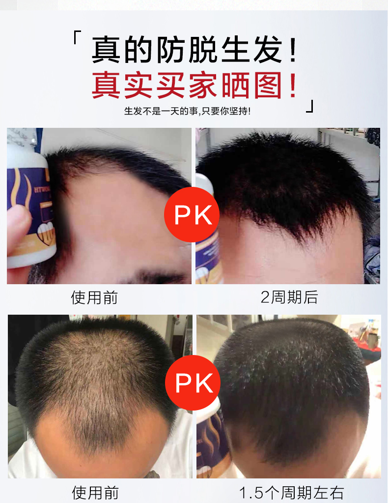 宜度海外专营店维生素h生物素biotin维生素b6片B7搭胱氨酸防脱发养血生发发胶囊1