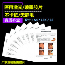 Hospital with porcelain white A4 inkjet film waterproof gastrointestinal mirror pathology B ultra-four-dimensional color ultrasound printing