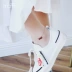 Meibumei Thời trang Hàn Quốc tính khí tua rua hạt chuông đỏ vòng chân nữ mạ vàng hồng màu vàng trang sức quà tặng - Vòng chân Vòng chân
