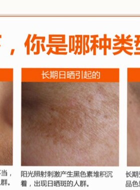 正品去班液特号去雀班 蝴蝶班