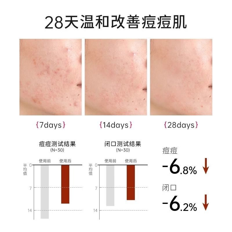 mkk植物精华祛痘消痘痘吸油收毛孔温和肌肤学生党光滑嫩肤正品 - 图2