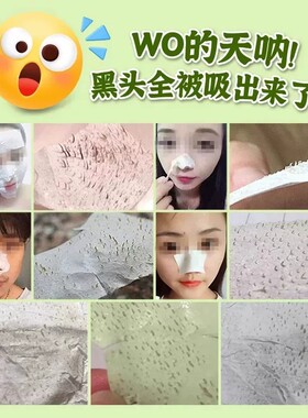 正品泰国去黑头神器芦荟胶鼻贴
