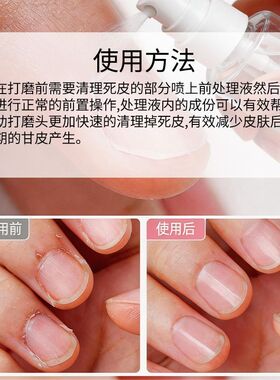 美甲俄式前置处理液去死皮不伤手喷雾辅助液角质快速软化剂大容量