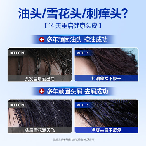 尊蓝洗发水男士专用洗头膏沐浴露套装去屑止痒控油蓬松持久留香液 - 图0