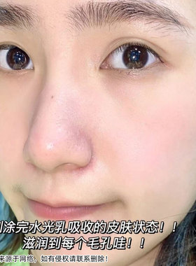 水光保湿！cetaphil丝塔芙玻尿酸水光凝乳补水清爽不油腻敏肌可用