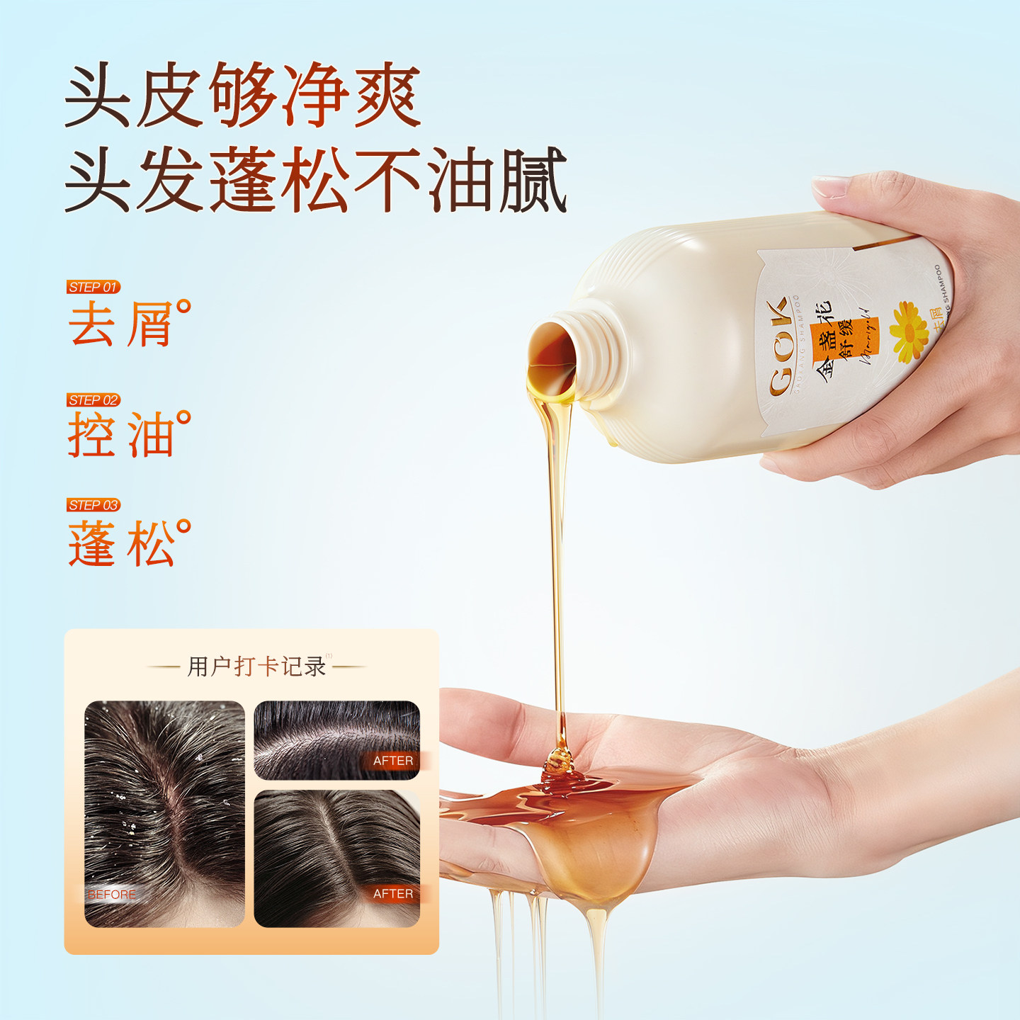 金盏花控油蓬松洗发水去屑止痒舒缓柔顺持久留香洗头膏露官方正品