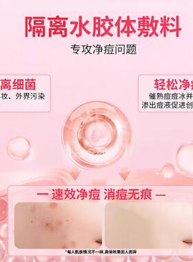 星星痘痘贴遮瑕祛痘可上妆