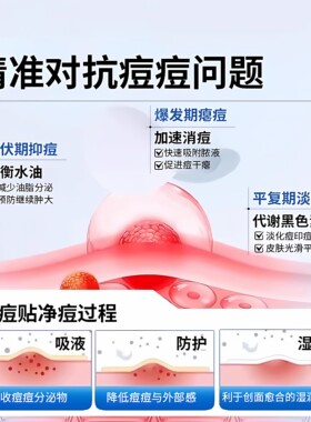 星星痘痘贴痘印贴人工皮水胶体敷料吸脓可上妆可爱豆豆遮瑕痘痘贴