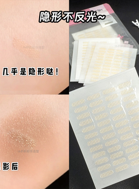 蕾丝双眼皮贴内双神器