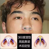 鼻撑扩张器 新人首单立减十元 21年7月 淘宝海外