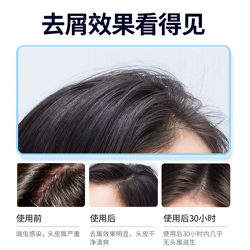 魔香旗舰店毛囊炎氨基酸洗发水头皮去螨虫屑除螨止痒护理控油膏露正品蓬松女3