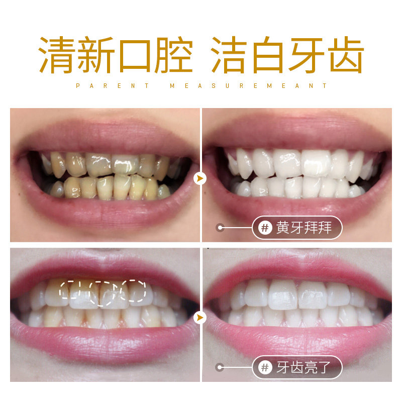  baimiss佰魅伊人素萃专卖牙粉