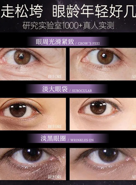 淡化细纹视黄醇补水保湿紧致眼霜