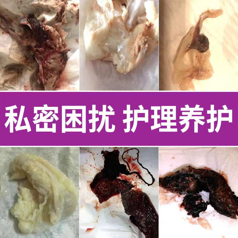 中药清宫丸正品排脏拉线妇科私密抑菌私处护理子宫保养排垃圾养巢 - 图1