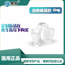 Polyggia Nasal Mold Hospital Booking of the Sumiddle Edition