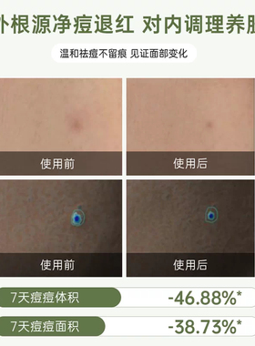 院线级！韩国Dr.urur小绿膜微晶海藻草本泥膜毛孔清洁涂抹面膜