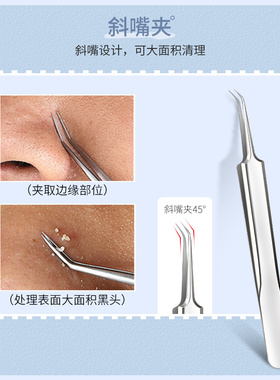 专业套装闭口挤痘痘工具粉刺针