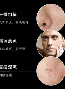 梵贞护肤品洗面奶控油补水套装
