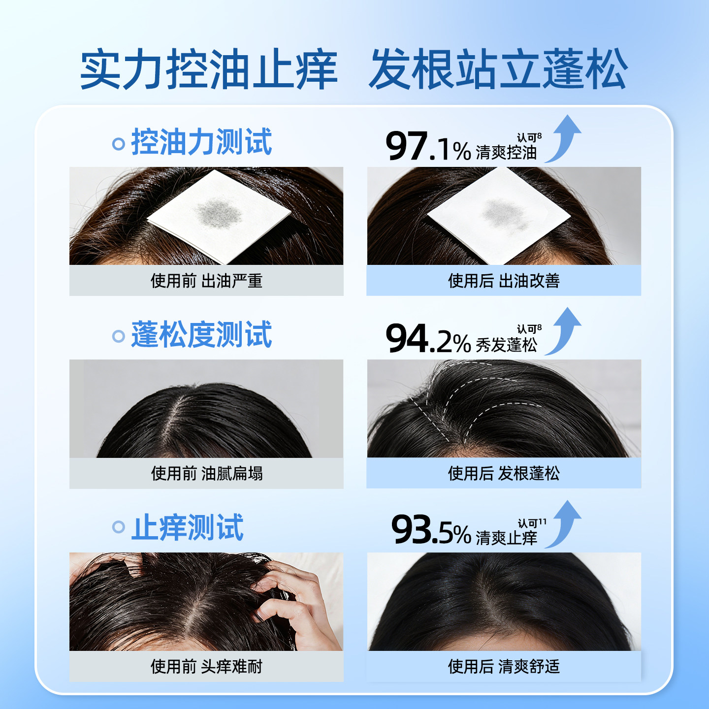 珍妮诗洗发水品牌男女去屑止痒洗发露净澈头皮控油蓬松去油洗头水