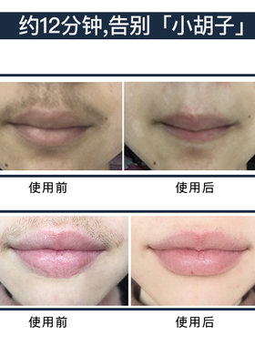 Fem唇部漂胡剂去小胡子神器