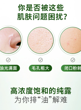 董欣马迷纯露去闭口粉刺平衡水油